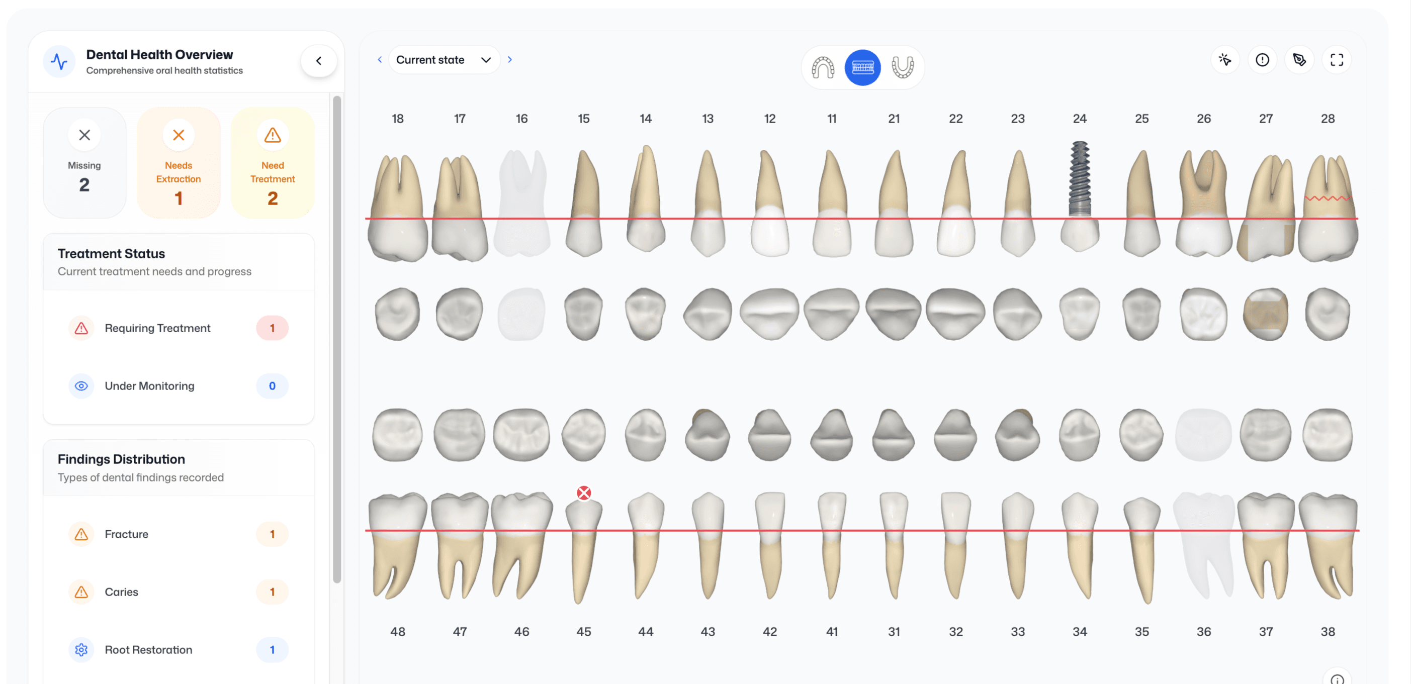 Zahn, und Parodontal-Charts screenshot