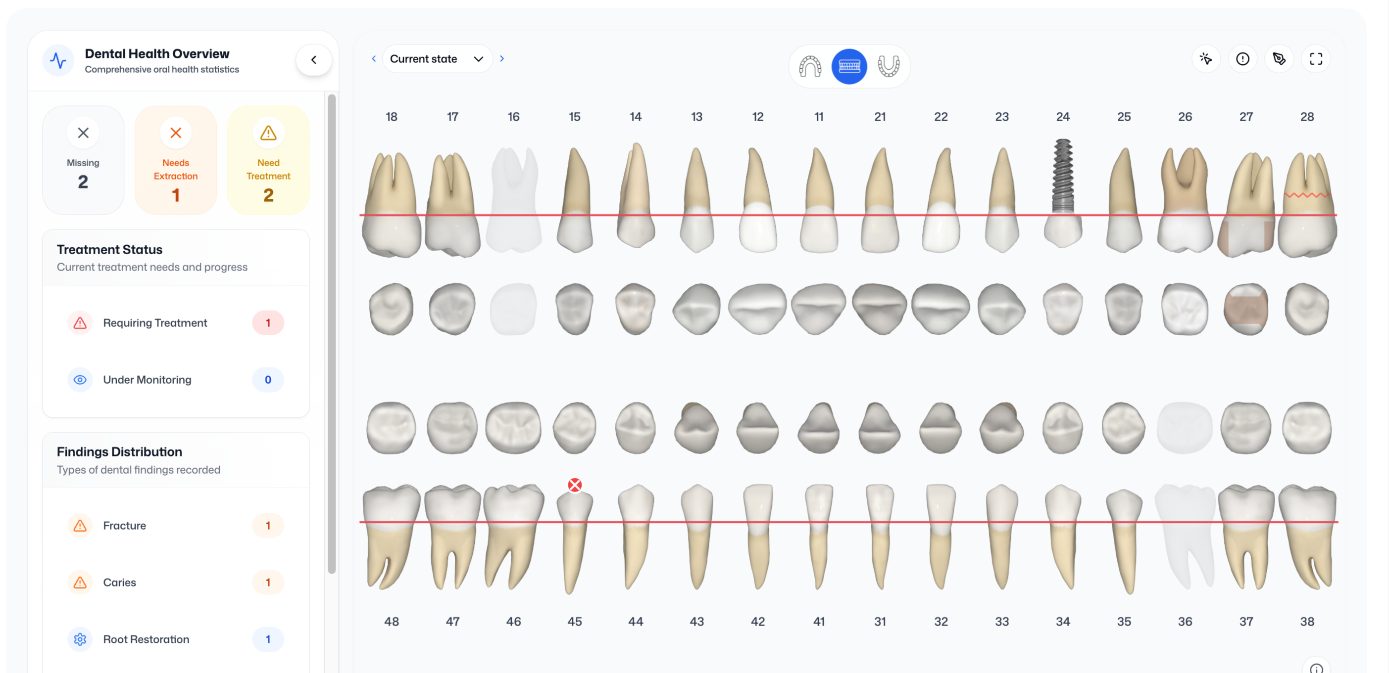 Dental & Perio Charts screenshot